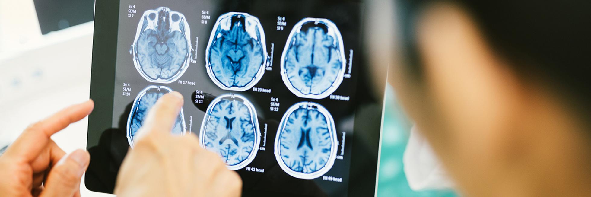 Arzt und Patient blicken auf Tablet mit CT-Ergebnissen